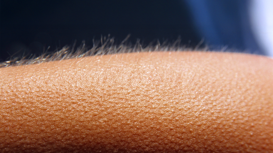 Close-up van een arm met kippenvel